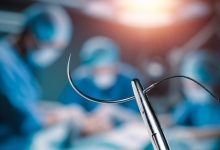 Stopping Bleeding, Cleaning, Closing, and Monitoring Without a Doctor – Survivopedia