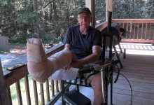 I Broke my Leg!